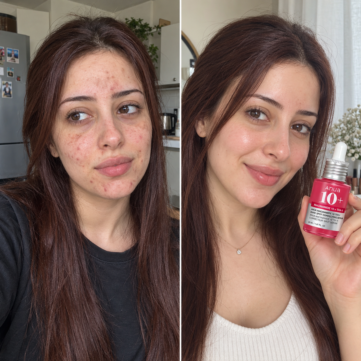 Anua 10+ Serum