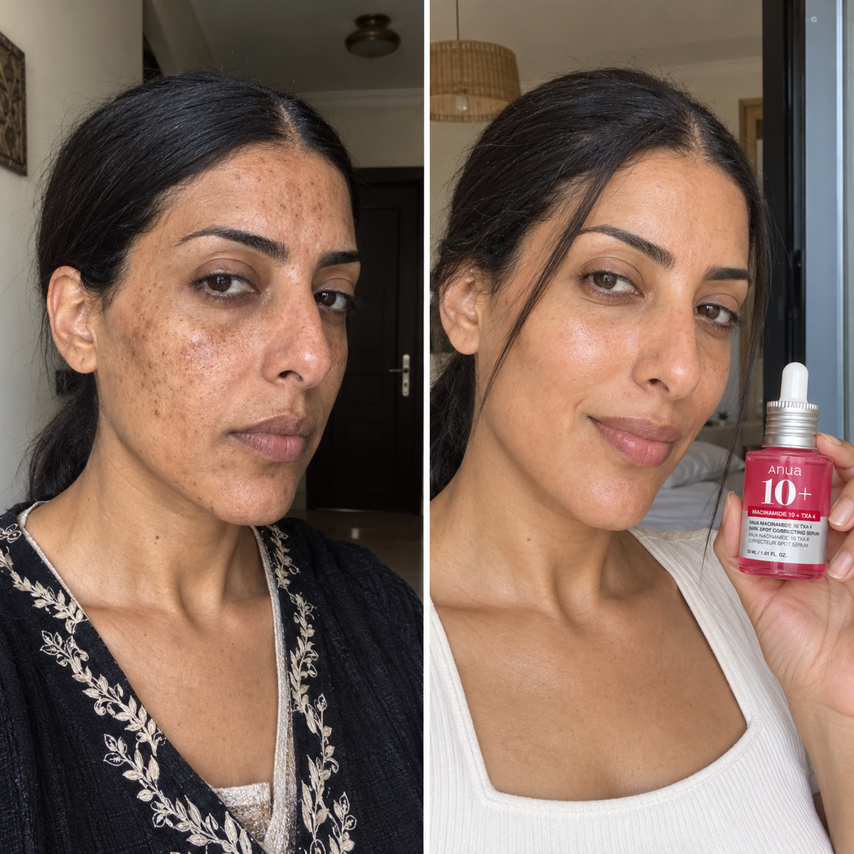 Anua 10+ Serum